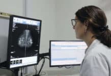 La provincia comenzará a indicar la mamografía a partir de los 40 años