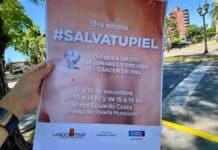 Controles gratuitos de lunares