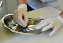 Se triplicaron los testeos de sífilis en Escobar gracias a las pruebas gratuitas en todos los CAPS